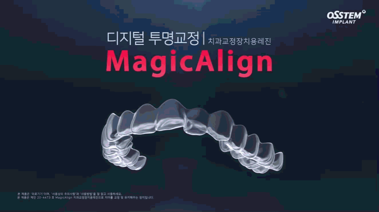 매직얼라인 투명교정 장치 잇몸선 재단 디자인
